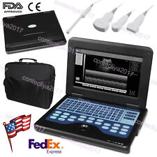 FDA CE 10.1 Inch Portable Ultrasound Scanner Laptop Machine CMS600P2 For Human picture