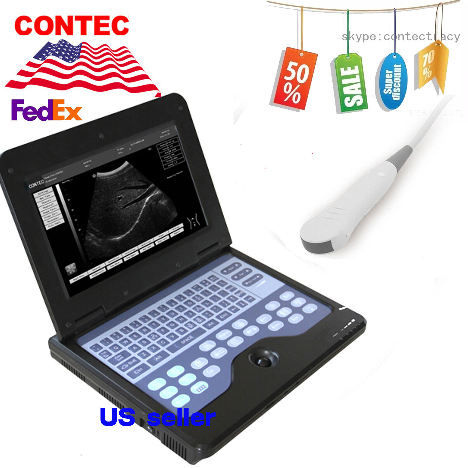 B-Ultrasound scanner Digital Disgnostic Portable machine,3.5mhz Micro convex,USA