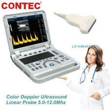 Portable Ultrasound Scanner Diagnostic Color Doppler Machine Linear Probe 1700A picture
