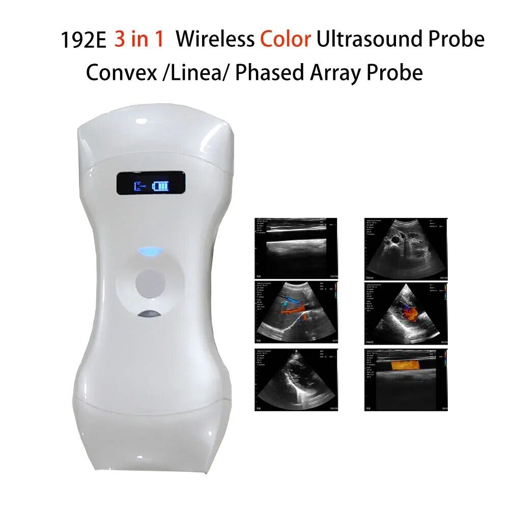 192 Elements Wireless Ultrasound Probe scanner support iOS Android Windows