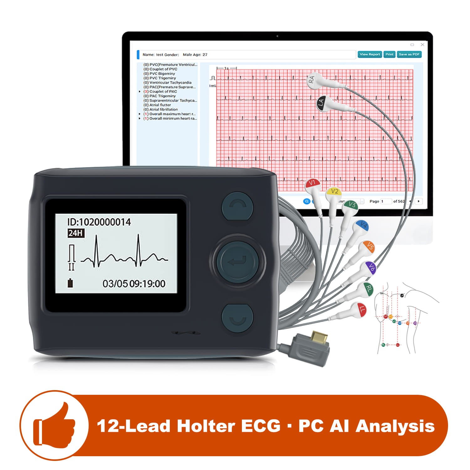 Livenpace TH12 12 Lead Holter Monitor 24h EKG Monitor w PC Software AI Analysis Livenpace TH12 12 Lead Holter Monitor 24h EKG Monitor w PC Software AI Analysis