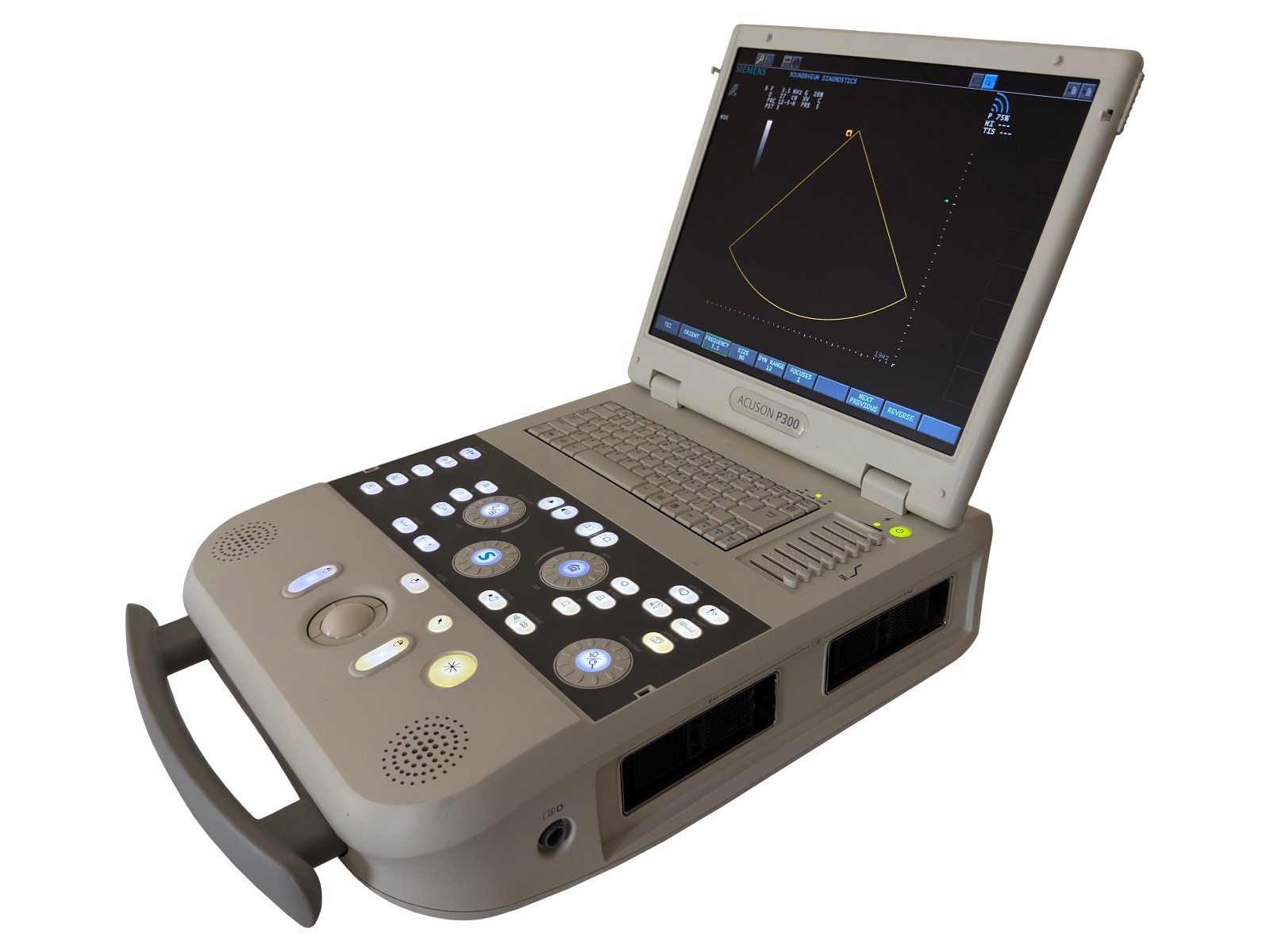 Siemens Acuson P300 Portable Ultrasound Machine System DICOM Cardiac MSK OB/GYN