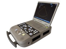 Siemens Acuson P300 Portable Ultrasound Machine System DICOM Cardiac MSK OB/GYN picture