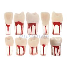 10Pcs Kilgore Nissin Dental RCT Endo Root canal Practise Typodont Teeth Model picture