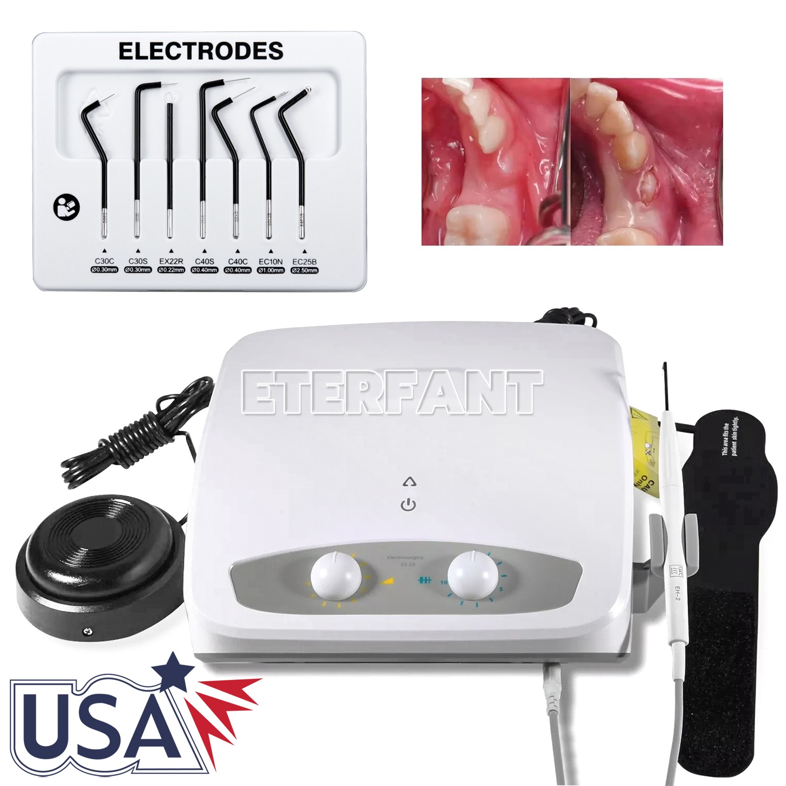 Dental Electro Electrosurgery Unit Machine High Frequency Electric w/7 Electrode Dental Electro Electrosurgery Unit Machine High Frequency Electric w/7 Electrode