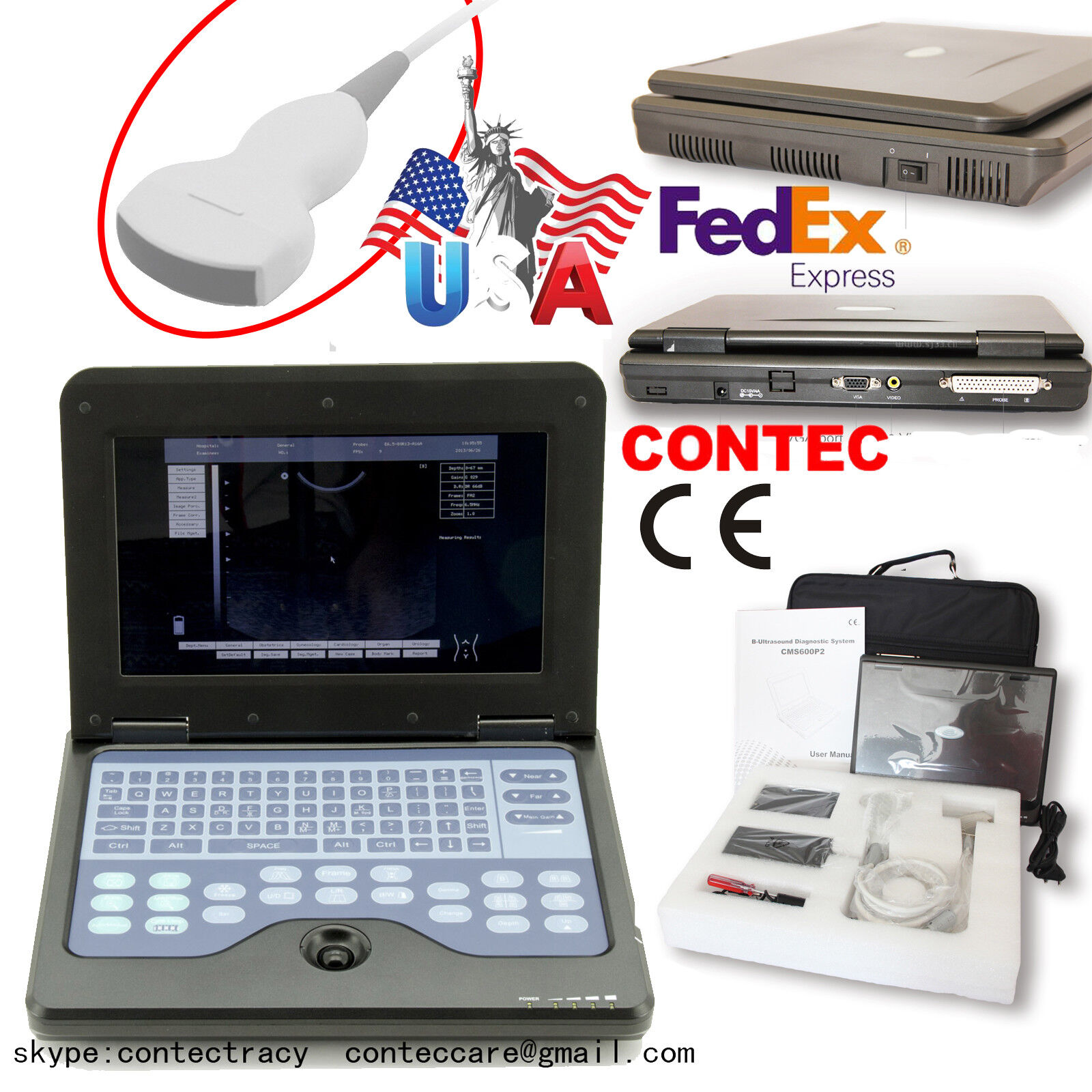 US CE Notebook Diagnostic Machine B Ultrasound Scanner Ultrasonic scanner,CONVEX