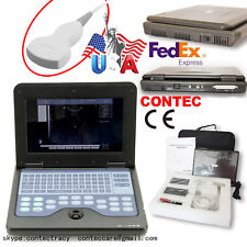US CE Notebook Diagnostic Machine B Ultrasound Scanner Ultrasonic scanner,CONVEX picture
