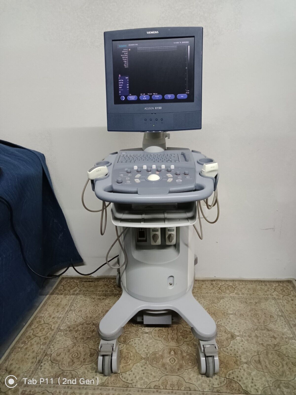 Siemens Acuson X150 Ultrasound + Two Probes- Used