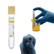 LabXcel 100mL Urine Specimen Containers Screw Cap with Transfer Device Lab Use picture