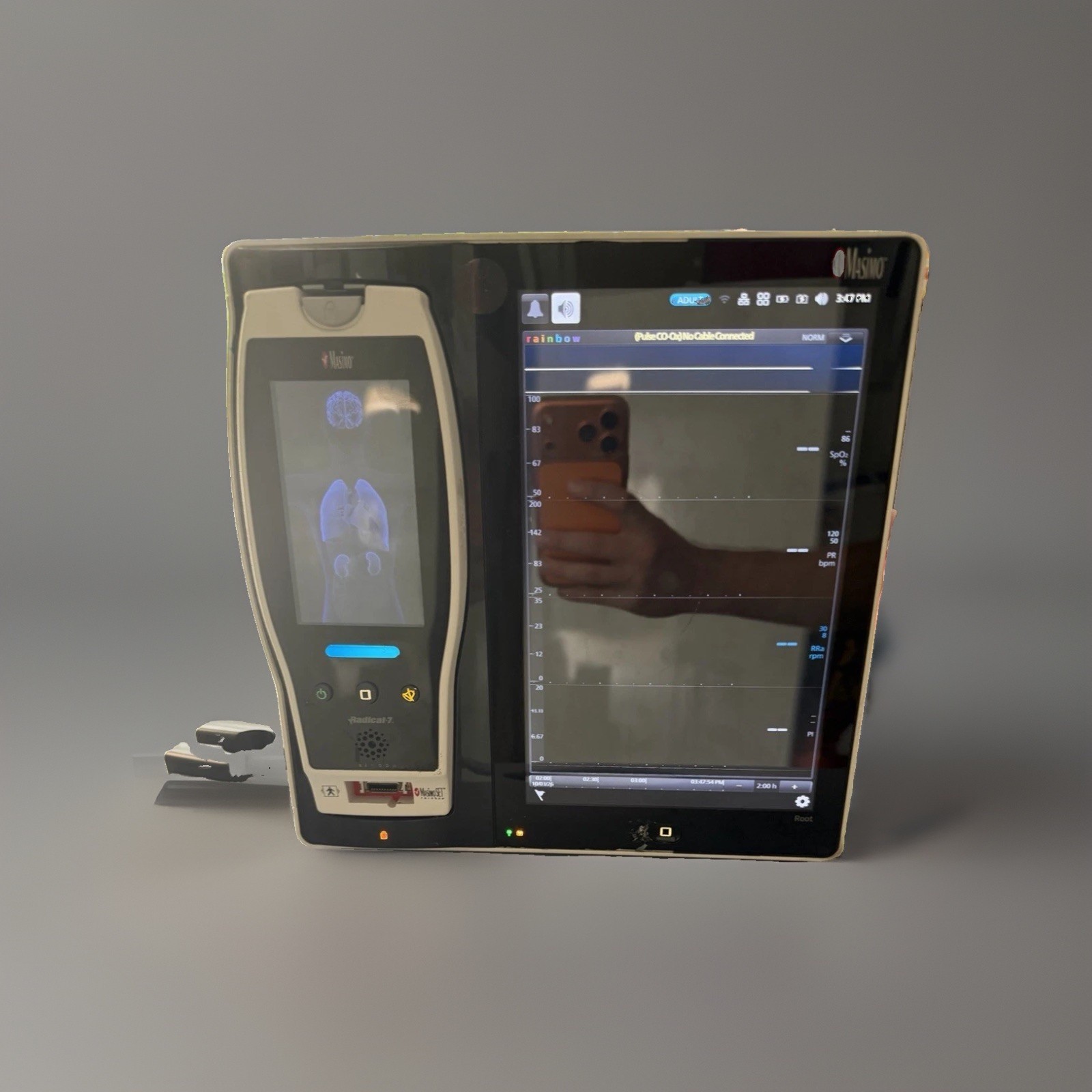 Masimo Root Monitor W/ Radical-7 Patient Monitor | fully functional | READ Masimo Root Monitor W/ Radical-7 Patient Monitor | fully functional | READ
