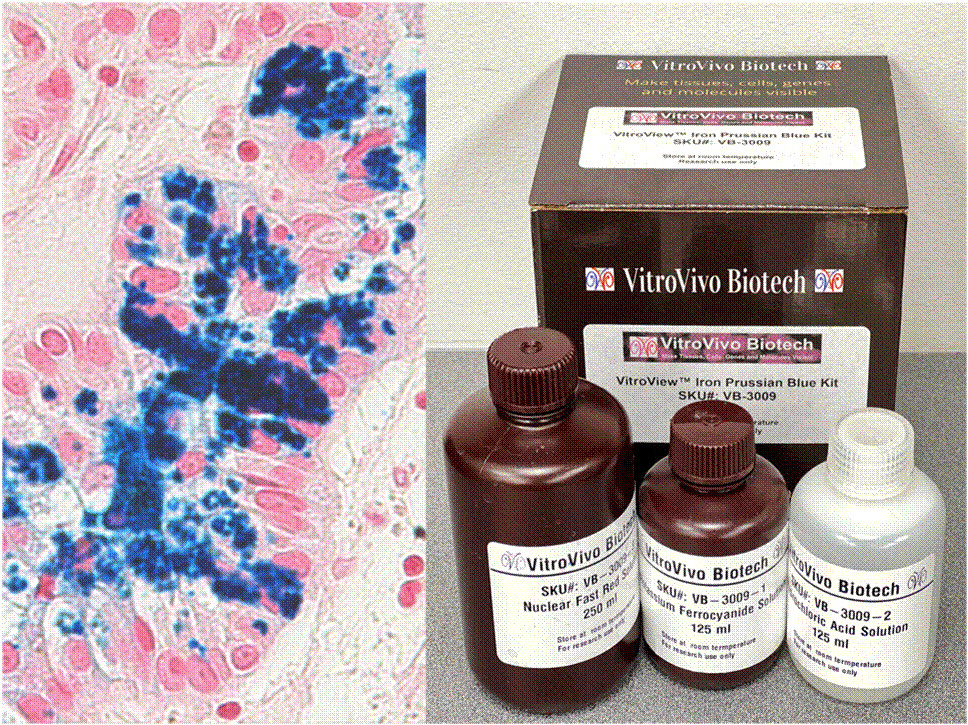 VitroView™ Prussian Blue Stain Kit (Cat# VB-3009) VitroView™ Prussian Blue Stain Kit (Cat# VB-3009)