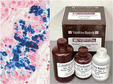 VitroView™ Prussian Blue Stain Kit (Cat# VB-3009) picture